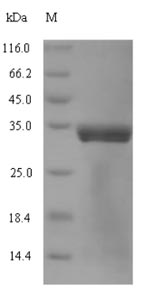 Bacterial dnaK protein