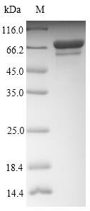 Viral NP protein