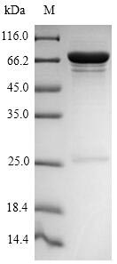 Viral NP protein