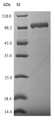 Viral Nucleoprotein protein