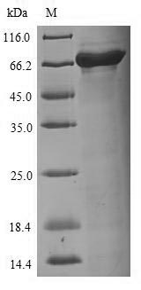 Viral Nucleoprotein protein