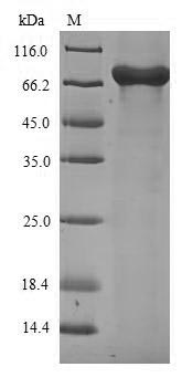 Viral NP protein