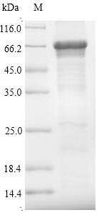 Human OPTN protein