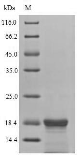 Viral LMP2 protein