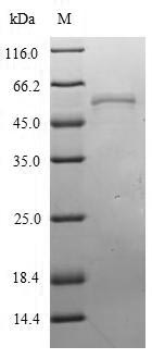 Viral NP protein