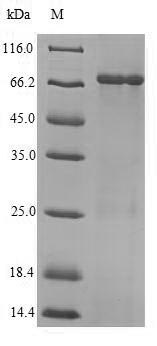 Viral NP protein