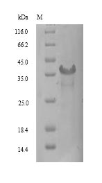 Human SIRPG protein