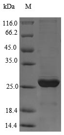 Viral gag protein