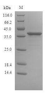 Human SIRPB1 protein