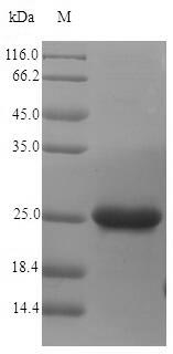 Bacterial nfuA protein