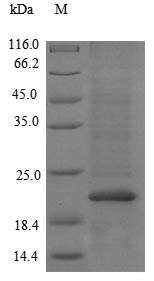 E. coli tsaE protein