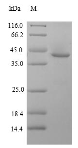 Human GLI2 protein