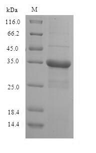 Human RPS10P5 protein