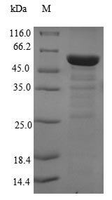 Human EIF3M protein