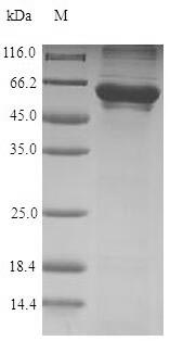 Human CCT6A protein