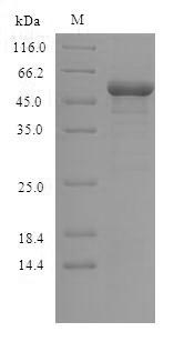 Human GSK3B protein