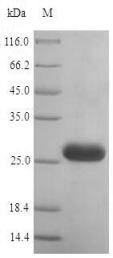 Human HRH1 protein