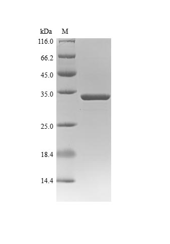 Viral NP protein