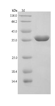 Human LGALS9 protein
