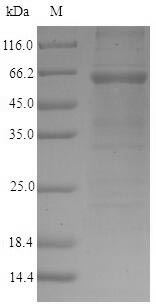 Mouse GP73 protein