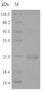 Mouse HDT2 protein