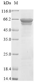 Viral Nucleoprotein protein
