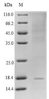 Human GLP1R protein