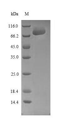 Human SPRED1 protein