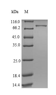 Human ATP5A1 protein