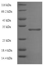 Human ATP5D protein