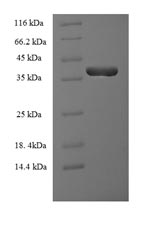Human CSF2 protein