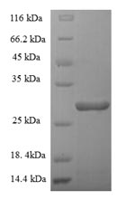 Human CSF2 protein