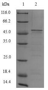 Human CYBB protein
