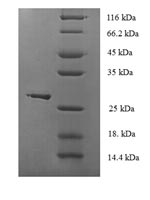 Human GPX1 protein