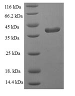 Human GPX1 protein