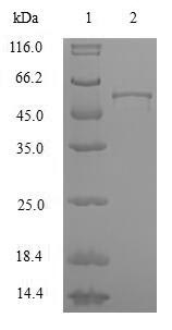 Human HNRNPA2B1 protein