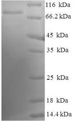 Human LCK protein