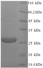 Human RS1 protein