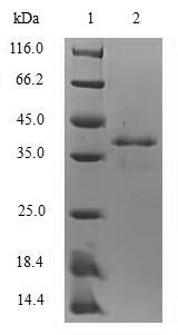 Mouse S100A8 protein