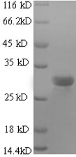 Bovine SFTPC protein