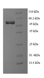 Human TARDBP protein