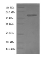 Human TXNL1 protein