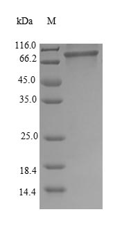 Human HNRNPM protein