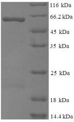 Viral GAG protein