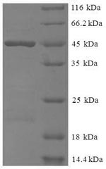 Human METRNL protein