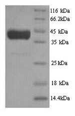 Yeast CYS4 protein