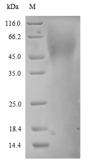 Human DNRA protein