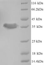 Bacterial ACPP protein