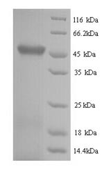 E. coli RTCB protein