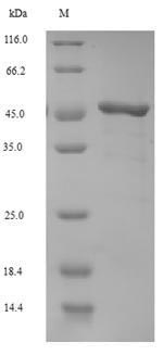 Viral GAG protein